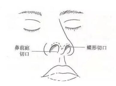 新版丨中国医大一院整形外科价目表，附医生团队+整形案例~