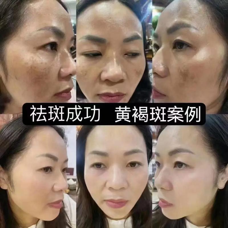 吉安人民医院整形科价目表2025新发布！附案例对比图大全！