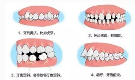 北大口腔第五门诊部贵吗？牙齿整形瘦脸案例分享