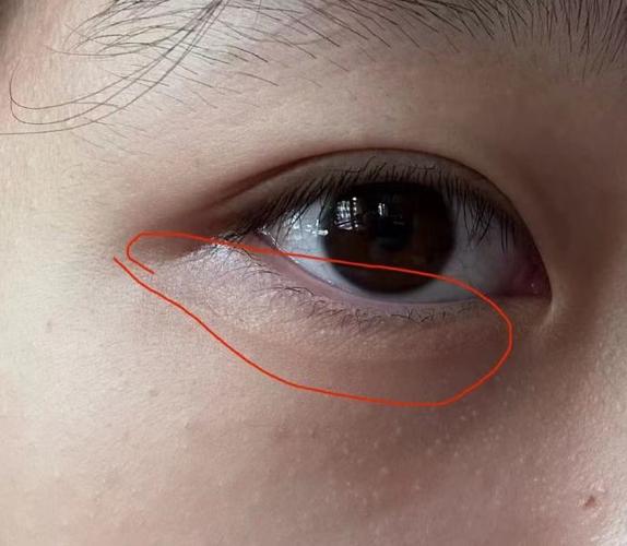 沈阳百嘉丽整形医院怎么样？价目表参考+术后效果反馈