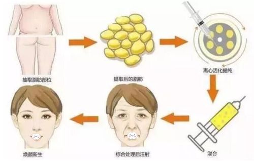 信阳负责人民医院整形医院价目表官方新版宣发~