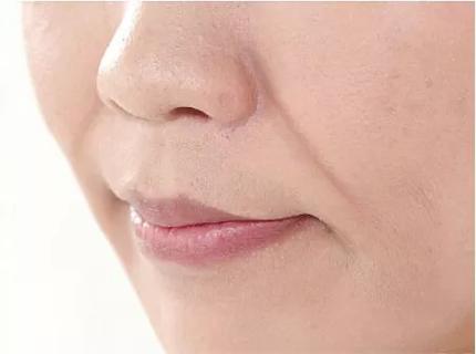 香港SWISSO医学美容旗舰店紧致轮廓效果好吗？真实案例+价格全解