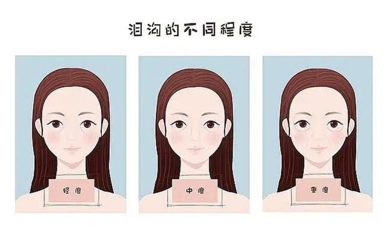 郑州德榕医疗美容医生有哪些？眼部塑形坐诊医院、案例对比请查收！