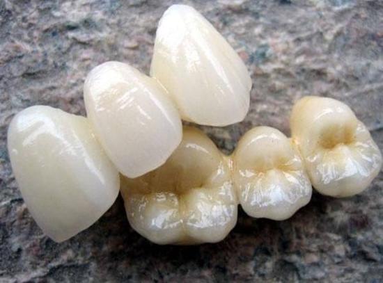 南京牙齿种植哪家医院技术好？五家热门医院详情对比