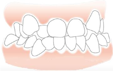 南宁牙齿矫正医院排名，5家专业口腔机构深度评测，本地患者真